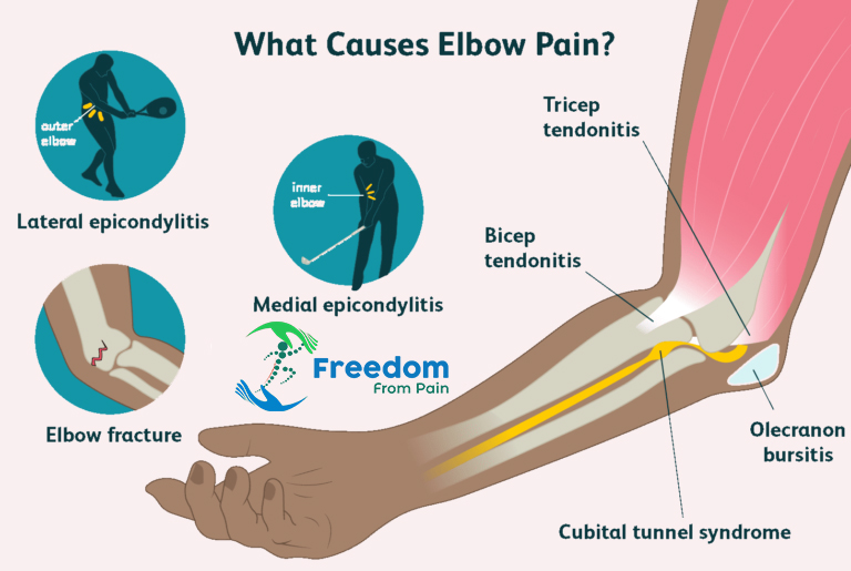 Elbow Pain Treatment In Hyderabad | Elbow Joint Pain specialist Doctors ...